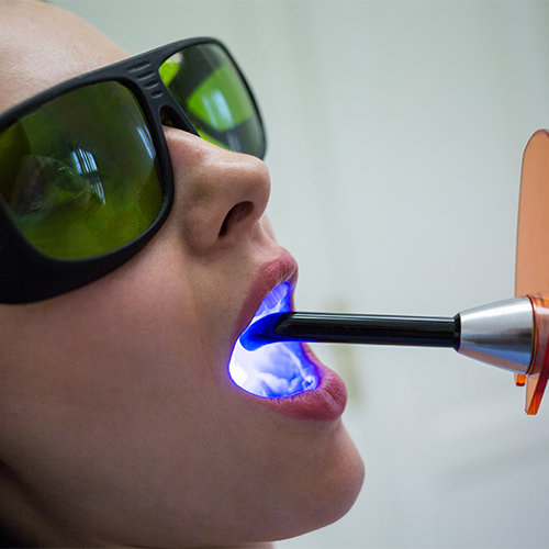 laser treatment