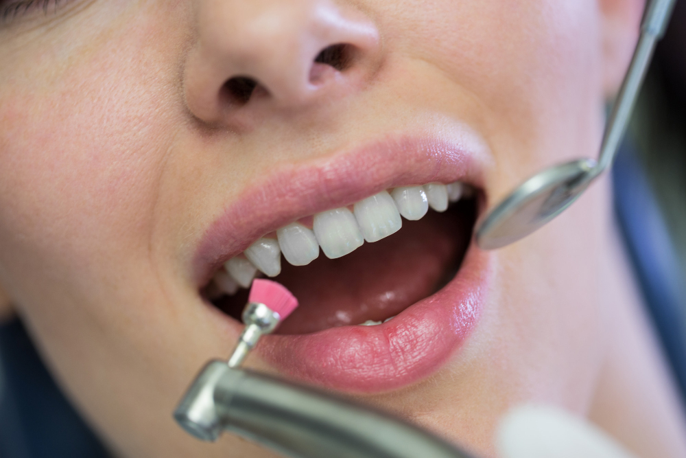 orthodontic treatment