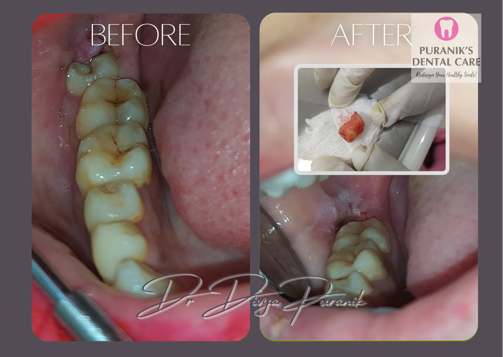 teeth before & after image