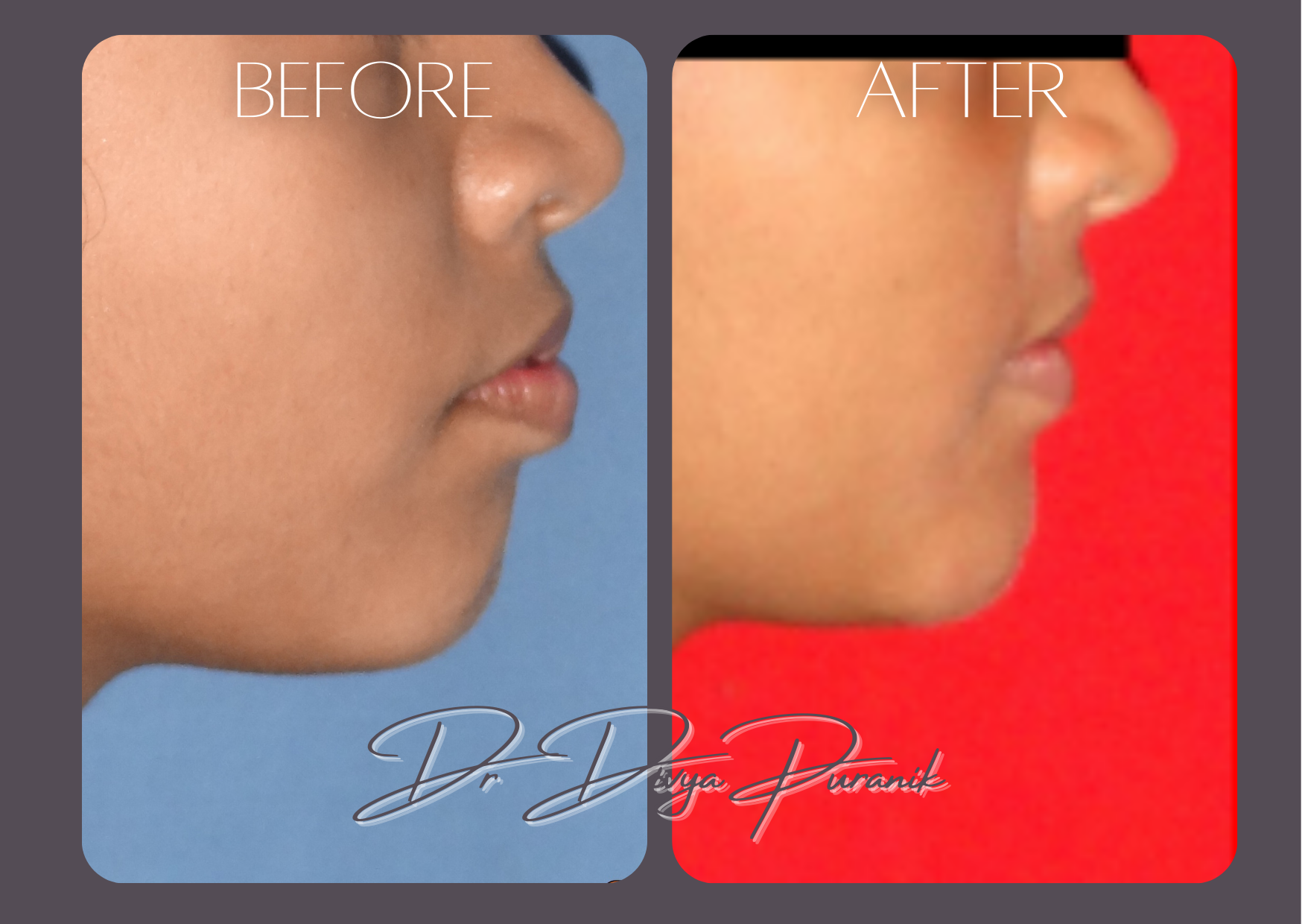 jaw treatment